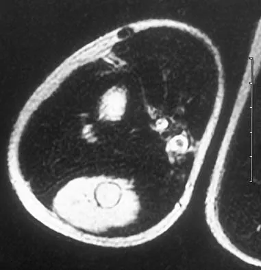 Basic Science Board Review 2005: High-Yield MCQs (Set 4) - Figure 19