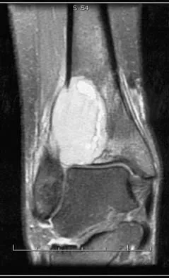 Basic Science Board Review 2005: High-Yield MCQs (Set 4) - Figure 2