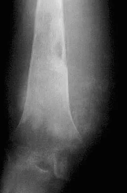 Basic Science Board Review 2005: High-Yield MCQs (Set 4) - Figure 22