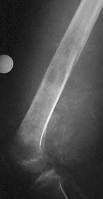 Basic Science Board Review 2005: High-Yield MCQs (Set 4) - Figure 23