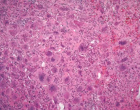 Basic Science Board Review 2005: High-Yield MCQs (Set 4) - Figure 3