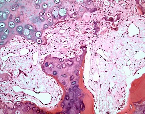 Basic Science Board Review 2005: High-Yield MCQs (Set 4) - Figure 32