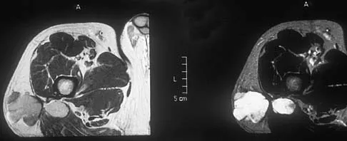 Basic Science Board Review 2005: High-Yield MCQs (Set 4) - Figure 33