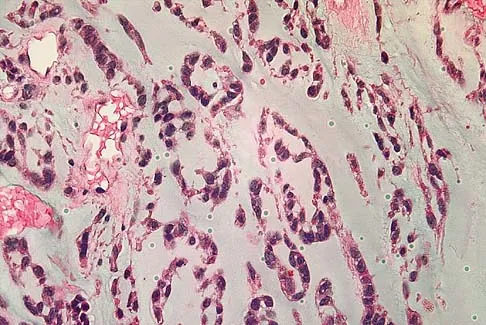 Basic Science Board Review 2005: High-Yield MCQs (Set 4) - Figure 35