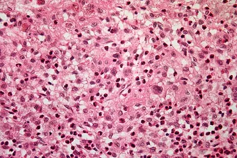 Basic Science Board Review 2005: High-Yield MCQs (Set 4) - Figure 9