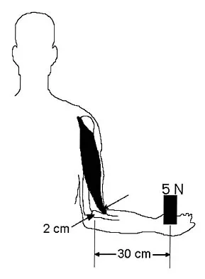 Basic Science 2006 Practice Questions: Set 1 (Solved) - Figure 9