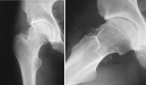 Basic Science 2006 Practice Questions: Set 3 (Solved) - Figure 2