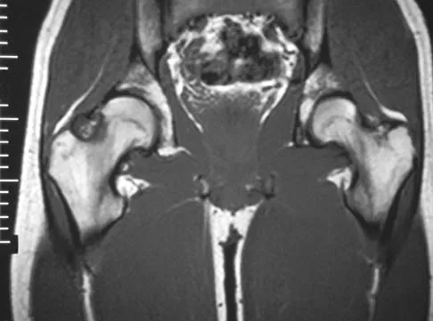 Basic Science 2006 Practice Questions: Set 3 (Solved) - Figure 4