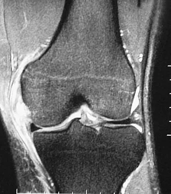 Basic Science 2006 Practice Questions: Set 3 (Solved) - Figure 5