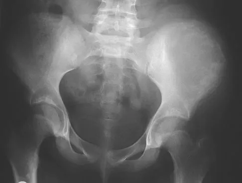 AAOS & ABOS Basic Science MCQs (Set 1): Biomechanics, Bone Physiology & Cartilage Biology for OITE