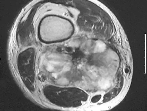 Basic Science 2008 Practice Questions: Set 1 (Solved) - Figure 12