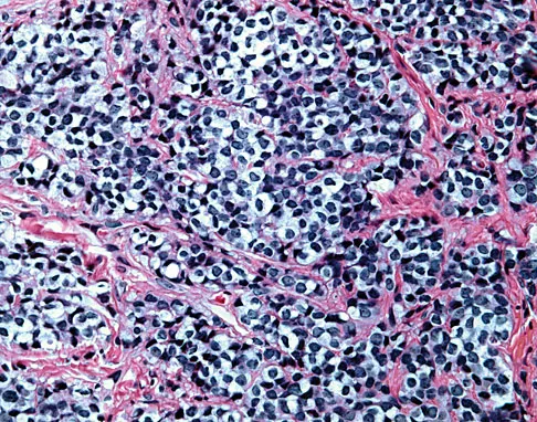 Basic Science 2008 Practice Questions: Set 1 (Solved) - Figure 18