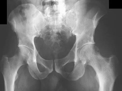 Basic Science 2008 Practice Questions: Set 1 (Solved) - Figure 19