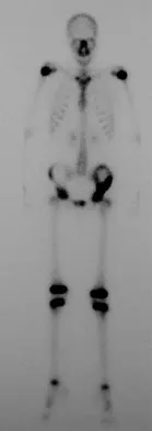 Basic Science 2008 Practice Questions: Set 1 (Solved) - Figure 2