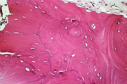 Basic Science 2008 Practice Questions: Set 1 (Solved) - Figure 23