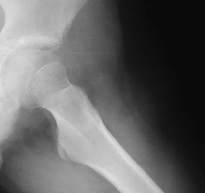 Basic Science 2008 Practice Questions: Set 1 (Solved) - Figure 25