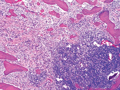 Basic Science 2008 Practice Questions: Set 1 (Solved) - Figure 36
