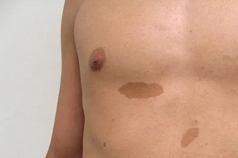 Basic Science 2008 Practice Questions: Set 1 (Solved) - Figure 40