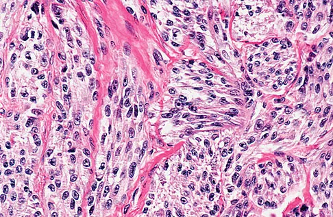 Basic Science 2008 Practice Questions: Set 1 (Solved) - Figure 41