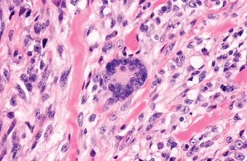 Basic Science 2008 Practice Questions: Set 1 (Solved) - Figure 42