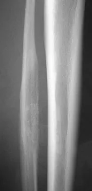 Basic Science 2008 Practice Questions: Set 1 (Solved) - Figure 49