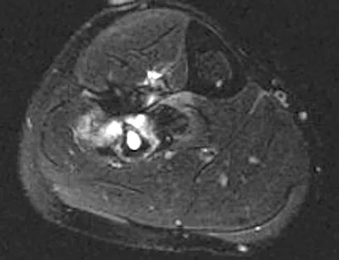 Basic Science 2008 Practice Questions: Set 1 (Solved) - Figure 50