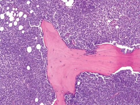 Basic Science 2008 Practice Questions: Set 1 (Solved) - Figure 51