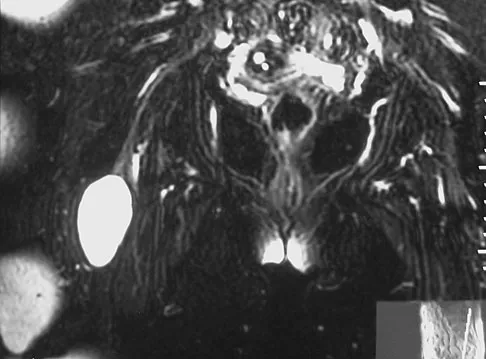 Basic Science 2008 Practice Questions: Set 1 (Solved) - Figure 59