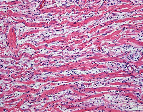 Basic Science 2008 Practice Questions: Set 1 (Solved) - Figure 60