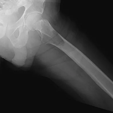 Basic Science 2008 Practice Questions: Set 1 (Solved) - Figure 73