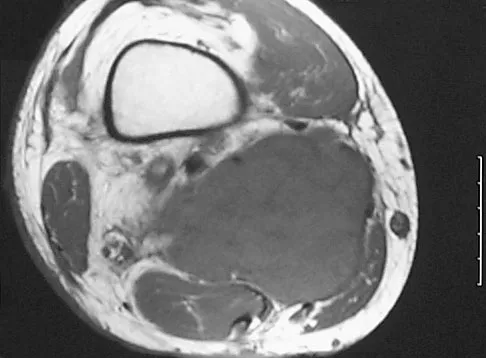 Basic Science 2008 Practice Questions: Set 1 (Solved) - Figure 8