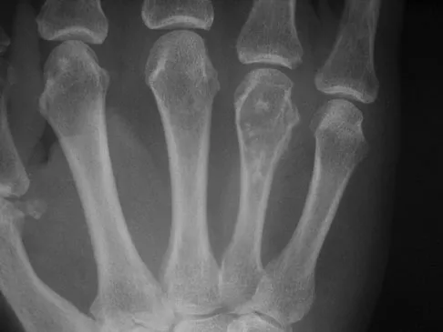 AAOS Orthopedic Basic Science MCQs (Set 2): Musculoskeletal Anatomy, Biomechanics & Physiology | Board Review