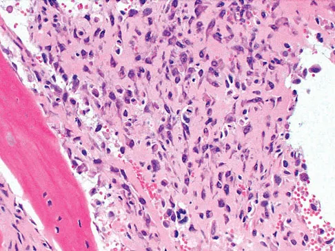 Basic Science Board Review 2008: High-Yield MCQs (Set 2) - Figure 12