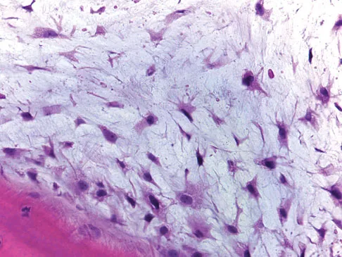 Basic Science Board Review 2008: High-Yield MCQs (Set 2) - Figure 17
