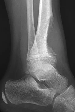 Basic Science Board Review 2008: High-Yield MCQs (Set 2) - Figure 22