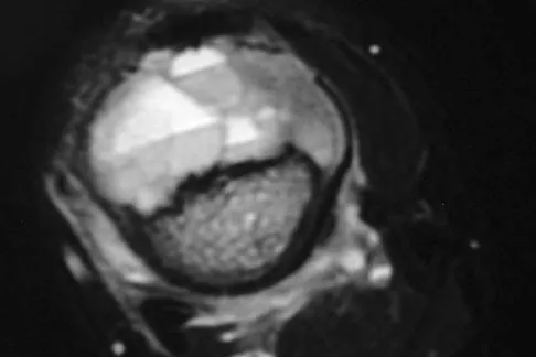 Basic Science Board Review 2008: High-Yield MCQs (Set 2) - Figure 23