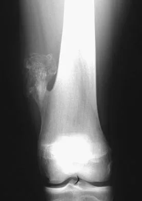 Basic Science Board Review 2008: High-Yield MCQs (Set 2) - Figure 26