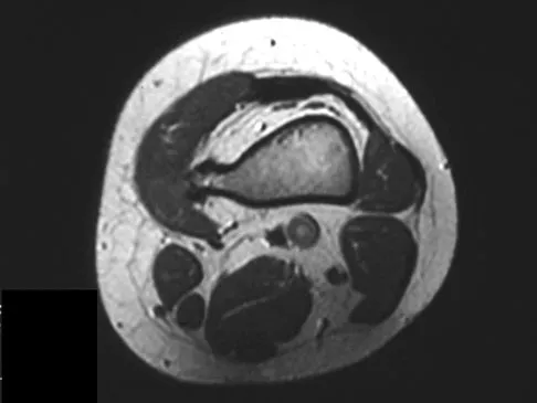 Basic Science Board Review 2008: High-Yield MCQs (Set 2) - Figure 27