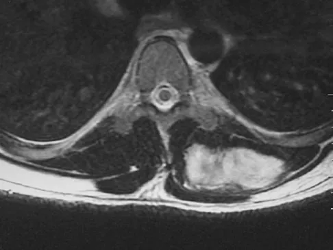 Basic Science Board Review 2008: High-Yield MCQs (Set 2) - Figure 32
