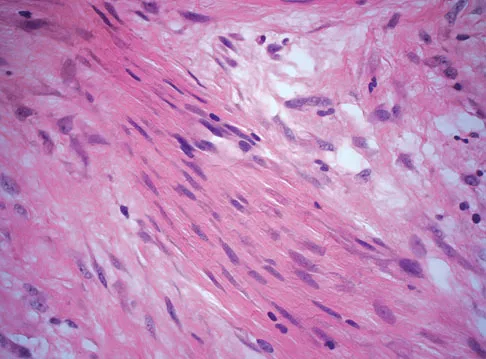 Basic Science Board Review 2008: High-Yield MCQs (Set 2) - Figure 35