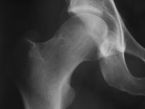 Basic Science Board Review 2008: High-Yield MCQs (Set 2) - Figure 37