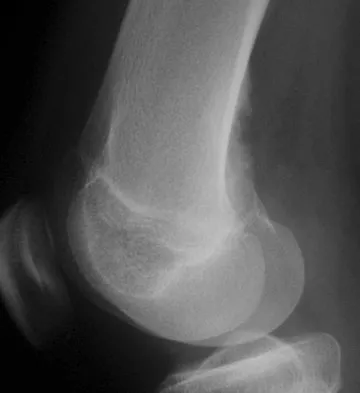 Basic Science Board Review 2008: High-Yield MCQs (Set 2) - Figure 4