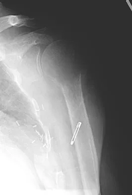 Basic Science Board Review 2008: High-Yield MCQs (Set 2) - Figure 47