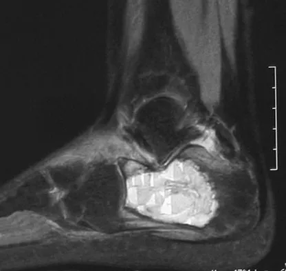 Basic Science Board Review 2008: High-Yield MCQs (Set 2) - Figure 52