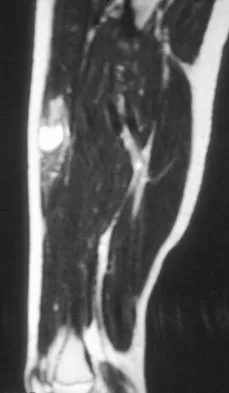 Basic Science Board Review 2008: High-Yield MCQs (Set 2) - Figure 58