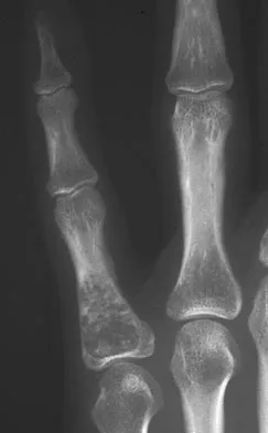 Basic Science Board Review 2008: High-Yield MCQs (Set 2) - Figure 62