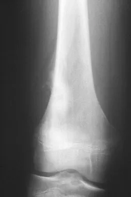 Basic Science Board Review 2008: High-Yield MCQs (Set 2) - Figure 8
