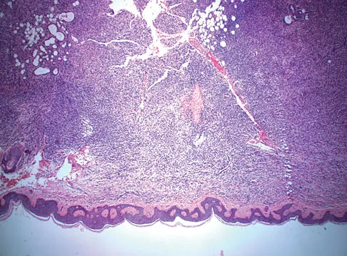 Basic Science 2008 Practice Questions: Set 3 (Solved) - Figure 11