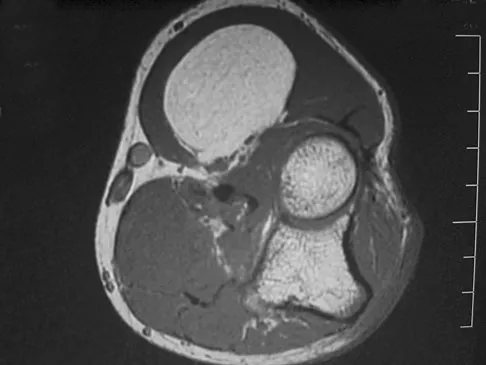 Basic Science 2008 Practice Questions: Set 3 (Solved) - Figure 14