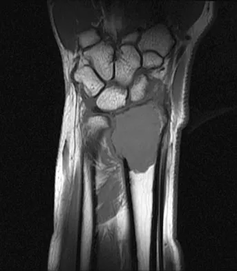 Basic Science 2008 Practice Questions: Set 3 (Solved) - Figure 17